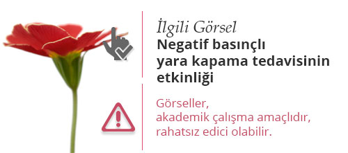 Negatif basınçlı yara kapama tedavisinin etkinliği.